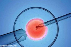 严重少弱精案例